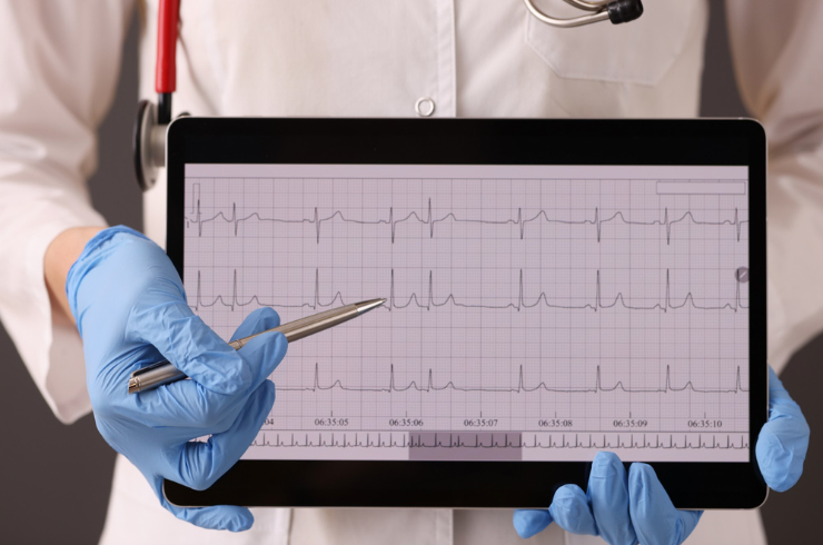 ECG (Electrocardiogram) Testing